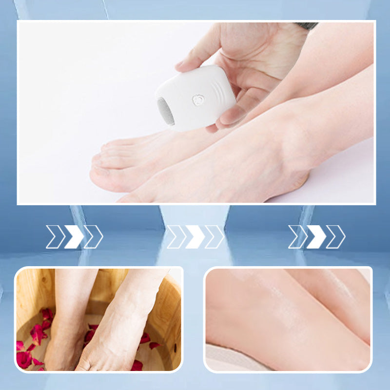 Automatic Callus Remover for Feet